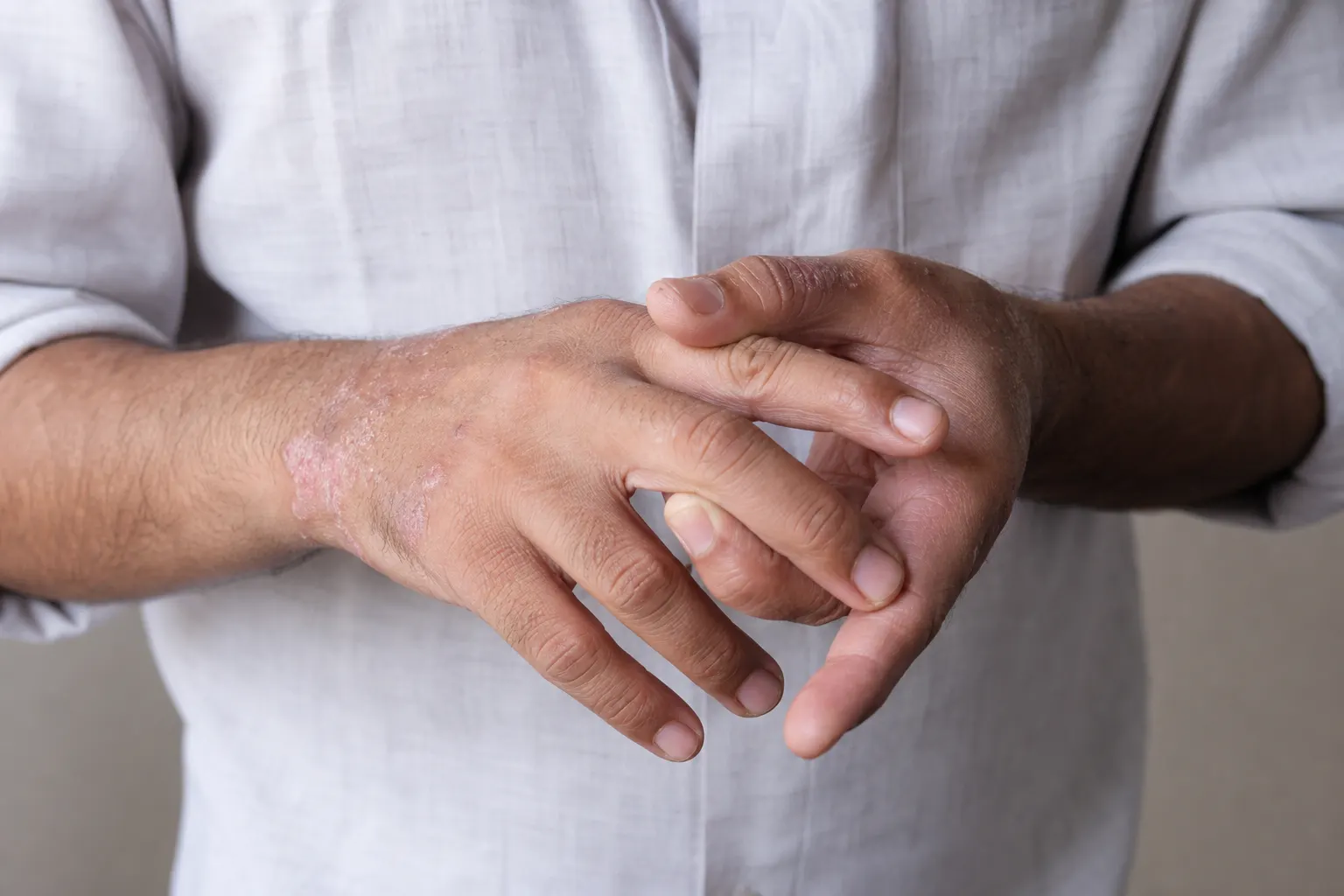Joint Stiffness — educational image for Psoriasis